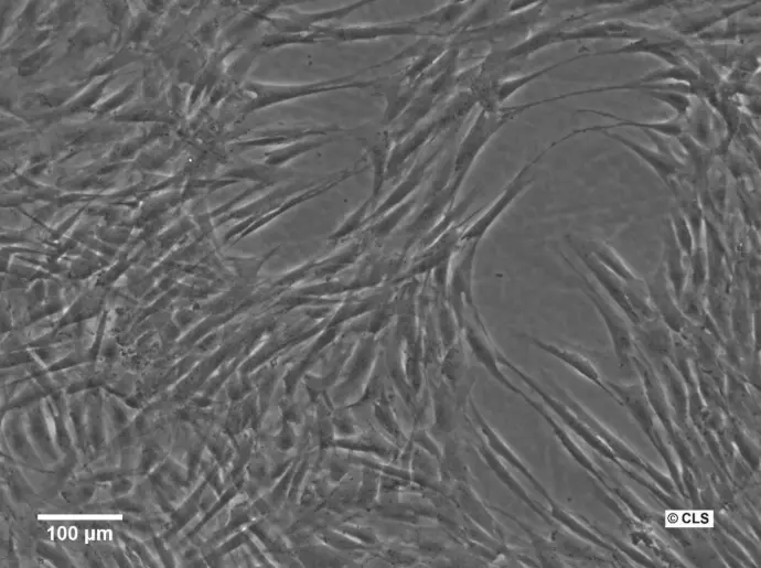 Human Foreskin Fibroblast Cells (HFFC)